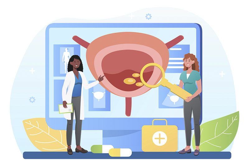 Ilustração de duas mulheres, uma delas com jaleco branco e a outra com uma lupa, analisando exame de uma bexiga e possível infecção urinária